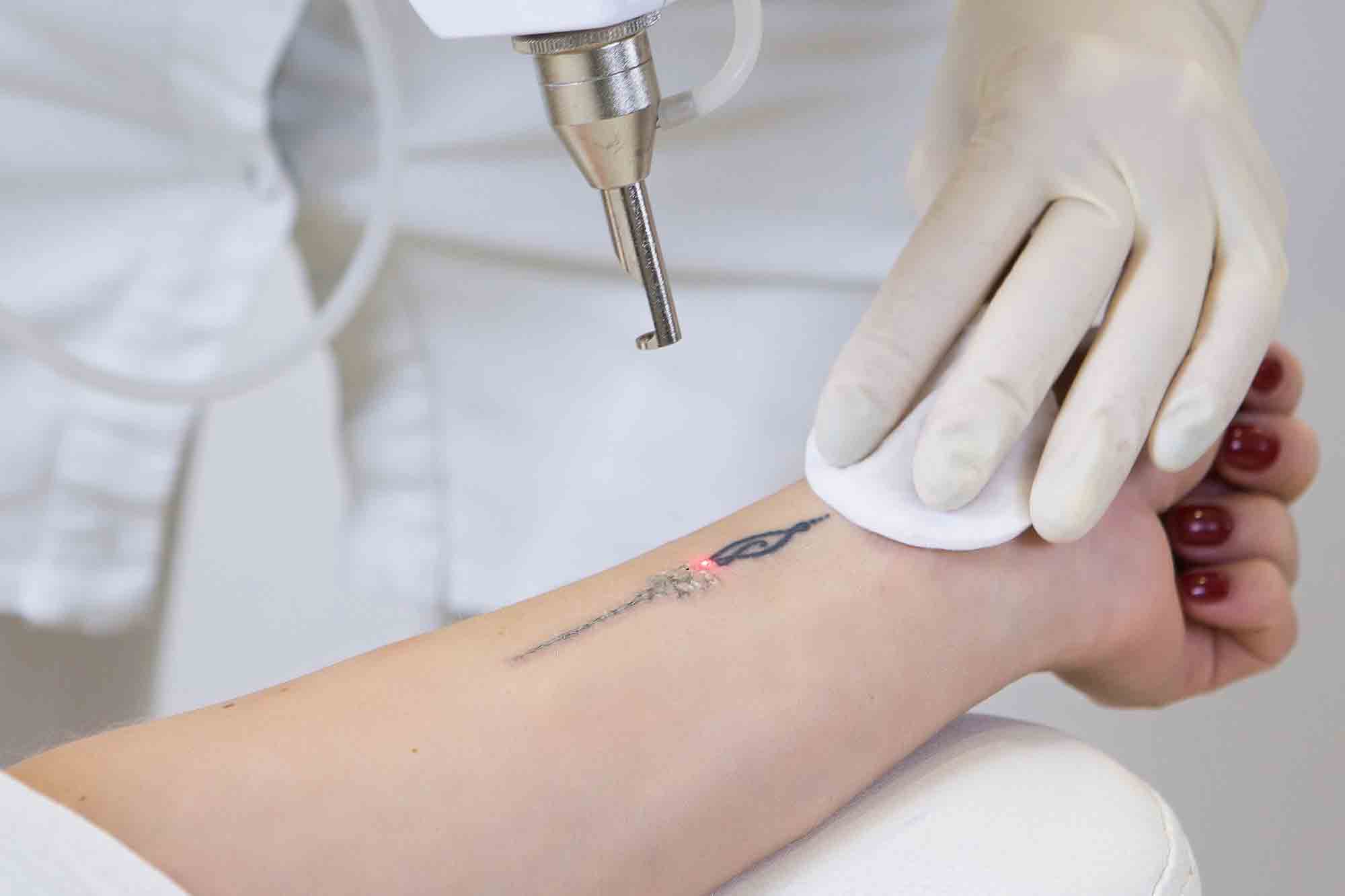 New Tattoos & Sun Exposure: Prevent Fresh Ink From Fading In the Sun -  Amandean